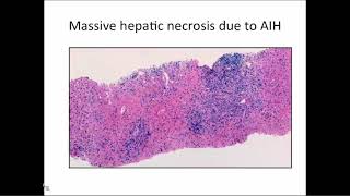 Overview of Liver Pathology