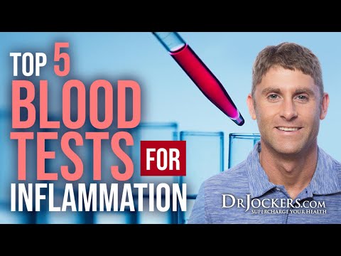 Top 5 Blood