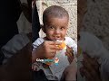 What is Ready-to-Use Therapeutic Food (RUTF) and how it can save a child's live.