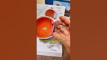 What is Keratoconus? Symptoms, Causes & Treatment | Bharti Eye Hospital