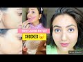 ALL ABOUT FACIAL HAIR REMOVAL AT HOME | चेहरे से बाल हटाने के सबसे आसान तरीके | Best Tips & Tricks