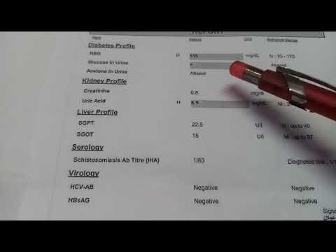 تحليل السكر العشوائي 