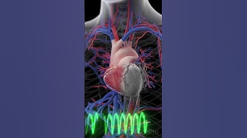 Kijk hoe een hartaanval zich ontvouwt! #anatomie #hartaanval