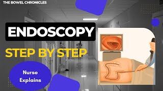 Endoscopy Step by Step: What Really Happens (Nurse Explains)