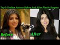 Top 14 Indian Actress Before And After Plastic Surgery