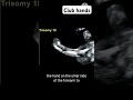 Club hands #radiology #pregnant #ultrasound #babyultrasound #baby #pregnancyscan