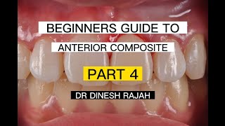 (Beginners guide to Anterior Composite Veneers (PART 4 OF 4) - REPAIRING AIR BUBBLES