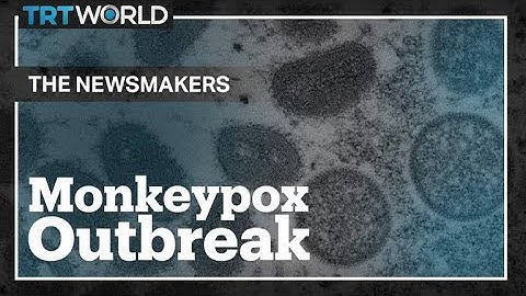 Monkeypox Outbreak