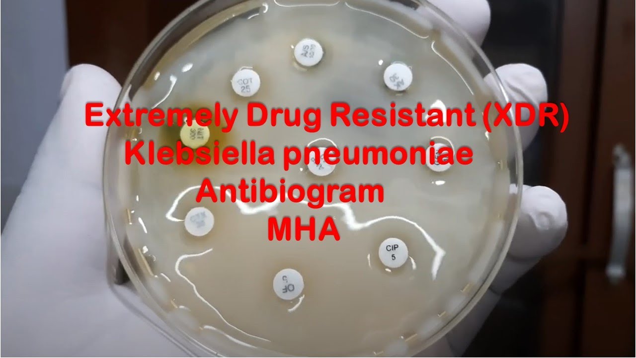 Extremely Drug Resistant (XDR) Klebsiella pneumoniae Demonstration