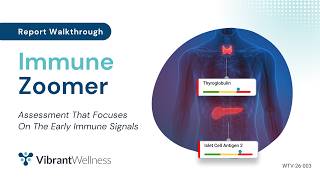 Immune Zoomer Report Walkthrough