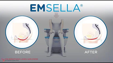 EMSELLA Incontinence & Intimacy Treatment at the Dermatology, Laser & Vein Center | Dr Shalini Gupta