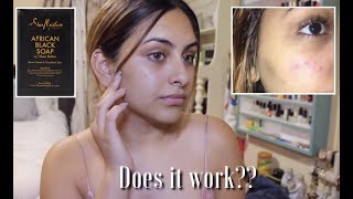 shea moisture overnight resurfacing serum reviews