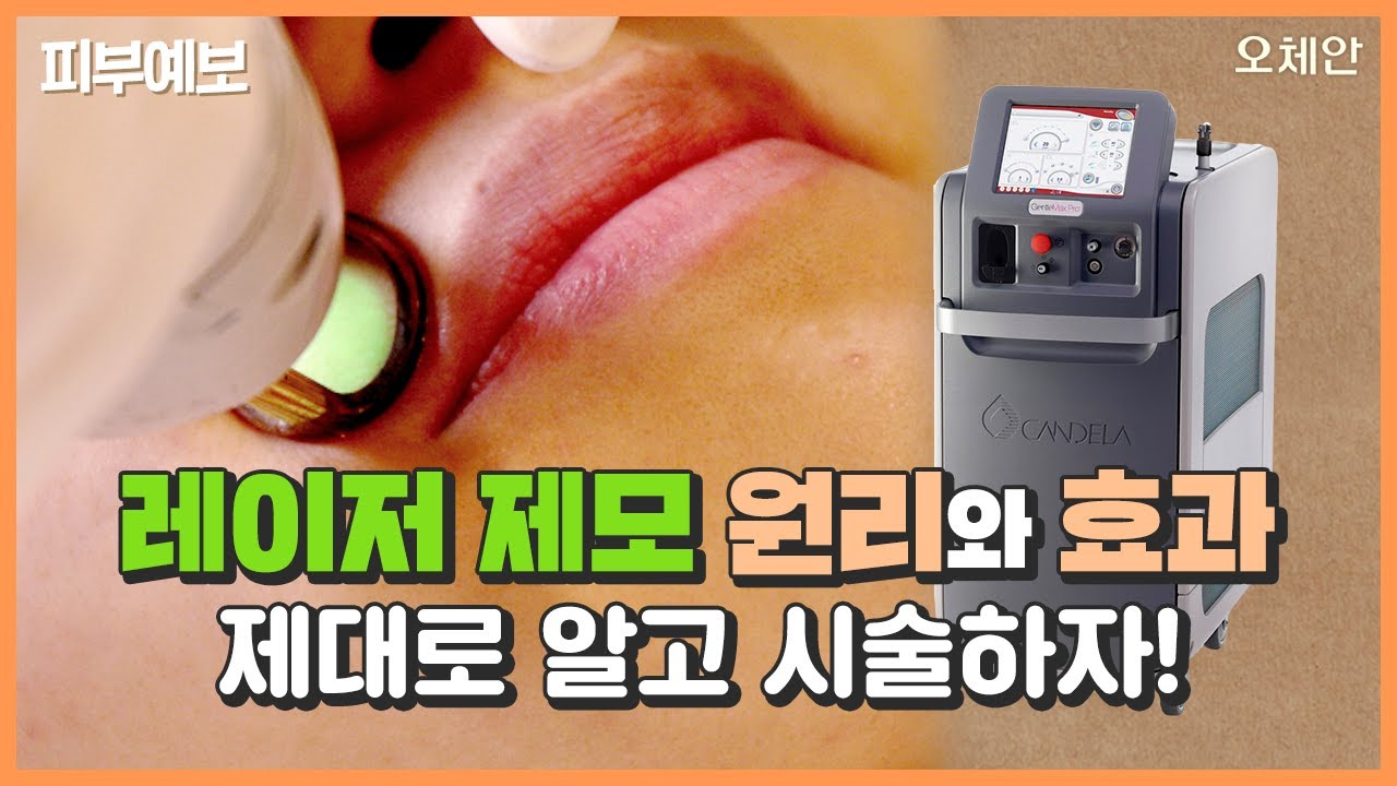 레이저 제모, 제대로 알고 하자! 레이저 제모의 원리와 효과 - YouTube