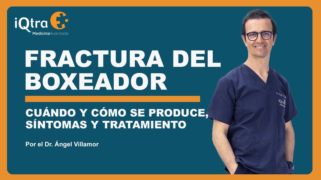 Fractura del quinto metacarpiano, así es la fractura del boxeador