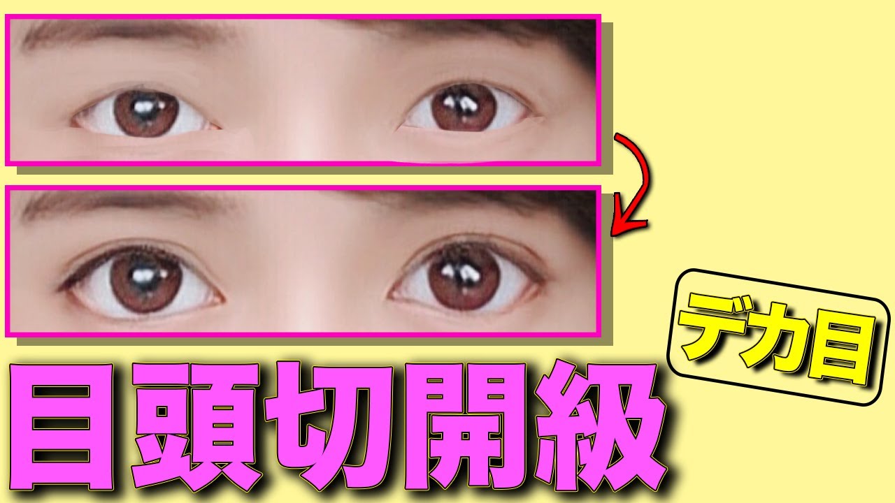 Home care Almond eye Suspended eyes Sauce eyes Incision in the