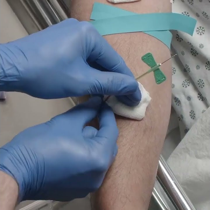 Blood draw with butterfly cannula youtube