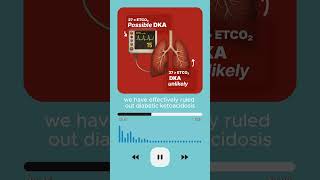 Using Entitled Co2 To Rule Out Dkapiece Of Cake Part Ii
