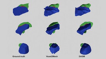 Deep Active Surface Models - Results - CVPR 2021