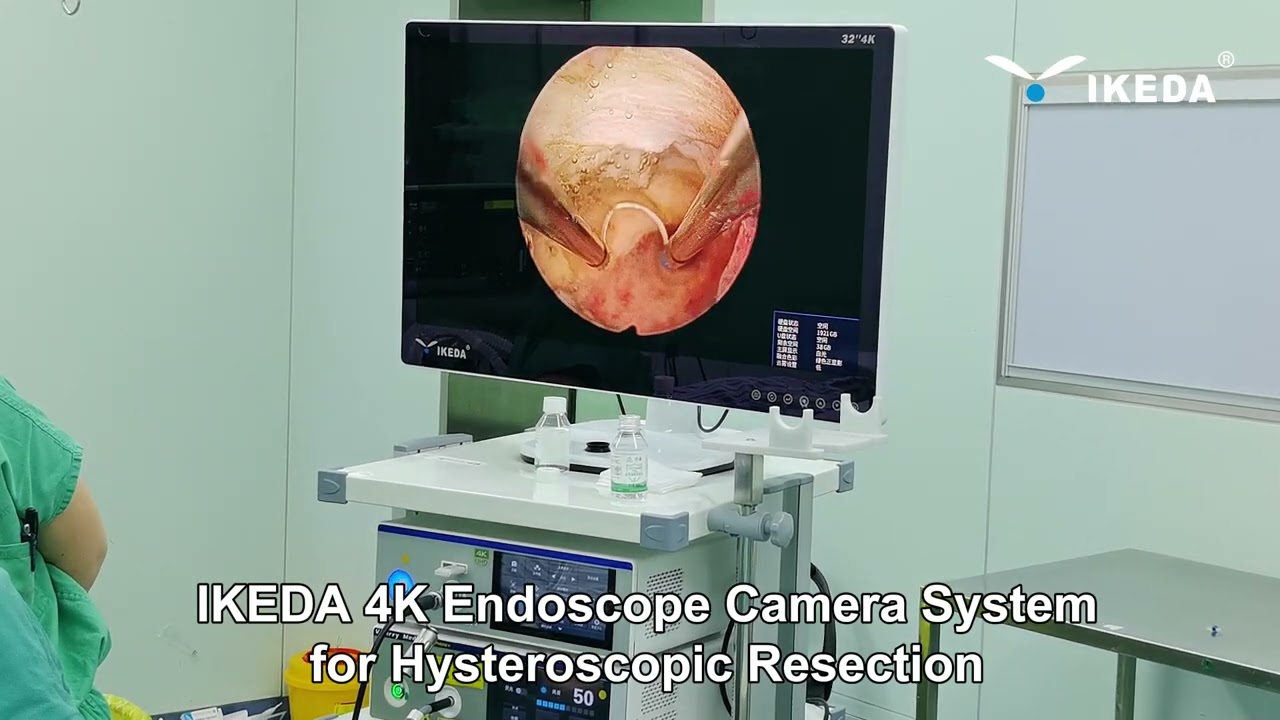 Three Surgeries, One Clear Winner: Our IKEDA 4K Endoscope System! 🏥