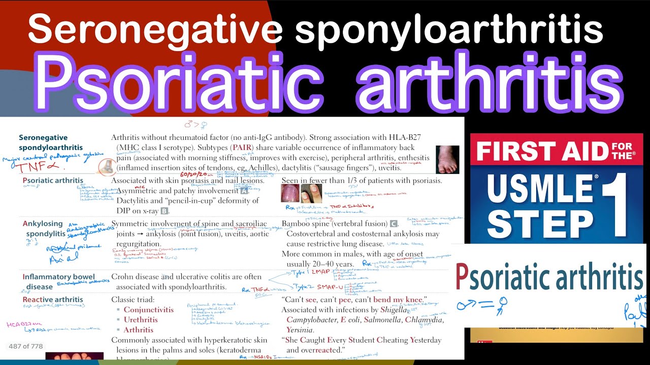 Psoriatic arthritis in Hindi/Urdu by first aid for USMLE step 1 - YouTube