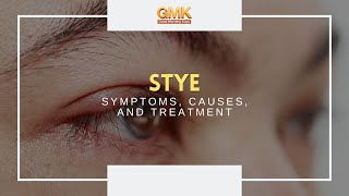 Download Lagu Stye Symptoms, Causes, and Treatment (Part 2) | Usapang Pangkalusugan MP3