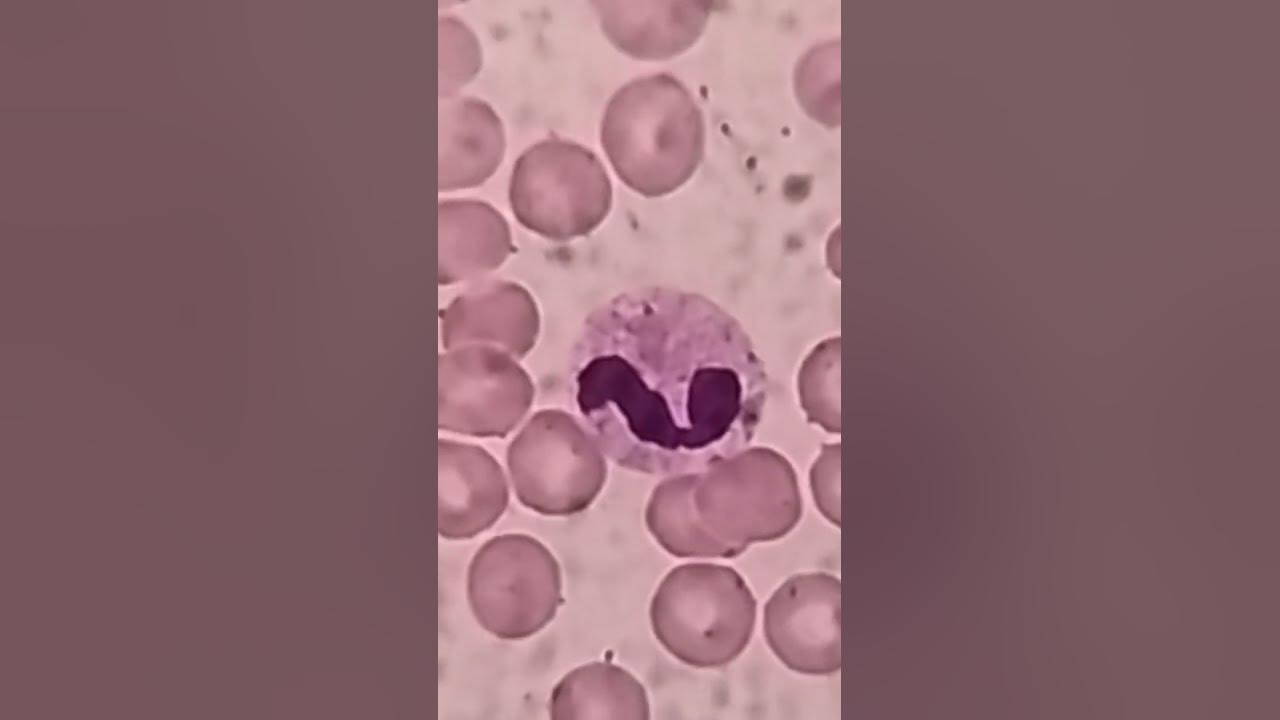 band-neutrophil-under-microscope-medical-pathology-hematology