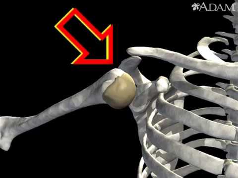 How Shoulder Dislocation Occurs Animation - Shoulder Joint Dislocation  Video - YouTube