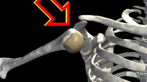 How Shoulder Dislocation Occurs Animation - Shoulder Joint Dislocation Video