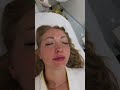 #клиникасочи #косметологсочи #губысочи