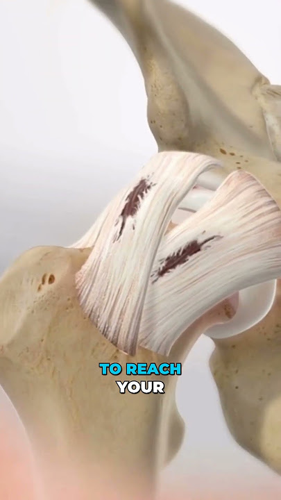 This Hidden Hip Problem Can Ruin Your Movement (3D Animation)