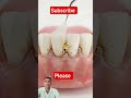 #doctor #dentist #human #💉💊🏥🦷🦷🏥💊💉🏥🦷🦷