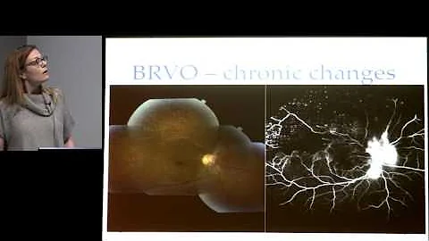 Retinal Vascular Disease