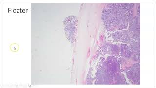 Artifacts in Histopathology and Cytopathology