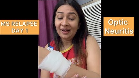Day 1- MS Relapse - Optic Neuritis