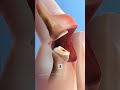 Mallet Finger Procedure (3D Animation) #mallet #finger #doctor #fracture #3danimation