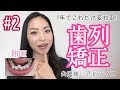 矯正1年後アップデート!ここまで変わりました♪