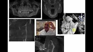 CBCT Principals of operation part 2