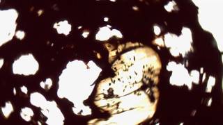 Celebrity Volcanic Bomb Thin Section Net Worth