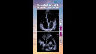 Which of the following seems most likely?