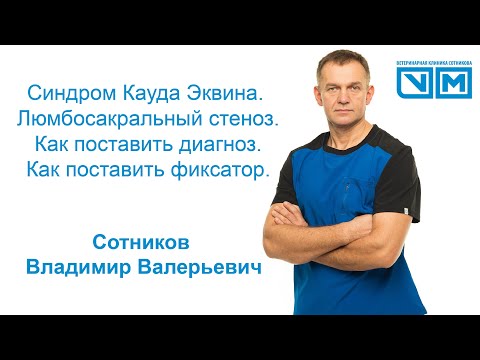 Бейне: Кауда Эквина синдромын қалай анықтауға болады: 15 қадам (суреттермен)