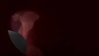 This Tiny Pill Is Actually A Camera To See Inside Your Stomach