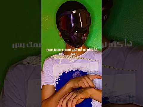 هيحصل ايه لو البرص مشي عليك او مشي علي الاكل معلومات Shorts