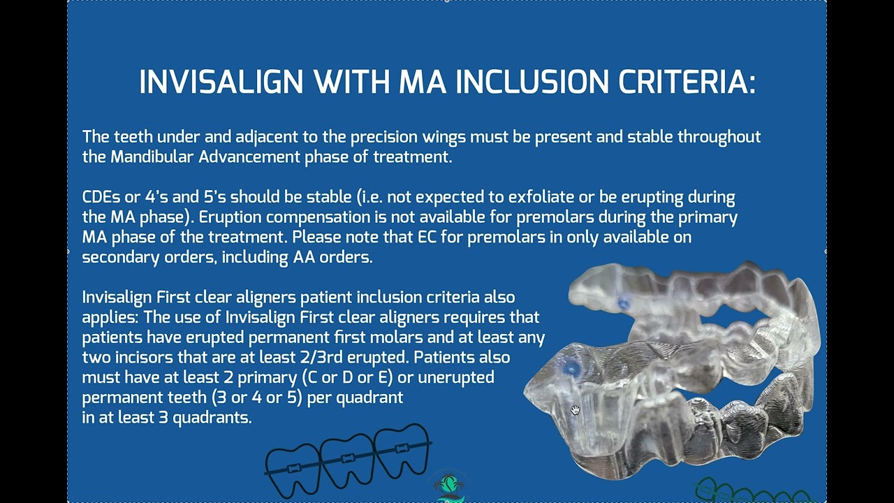Invisalign with MA Inclusion Criteria- Case Selection and Rejection- Missing Molars and Refinement