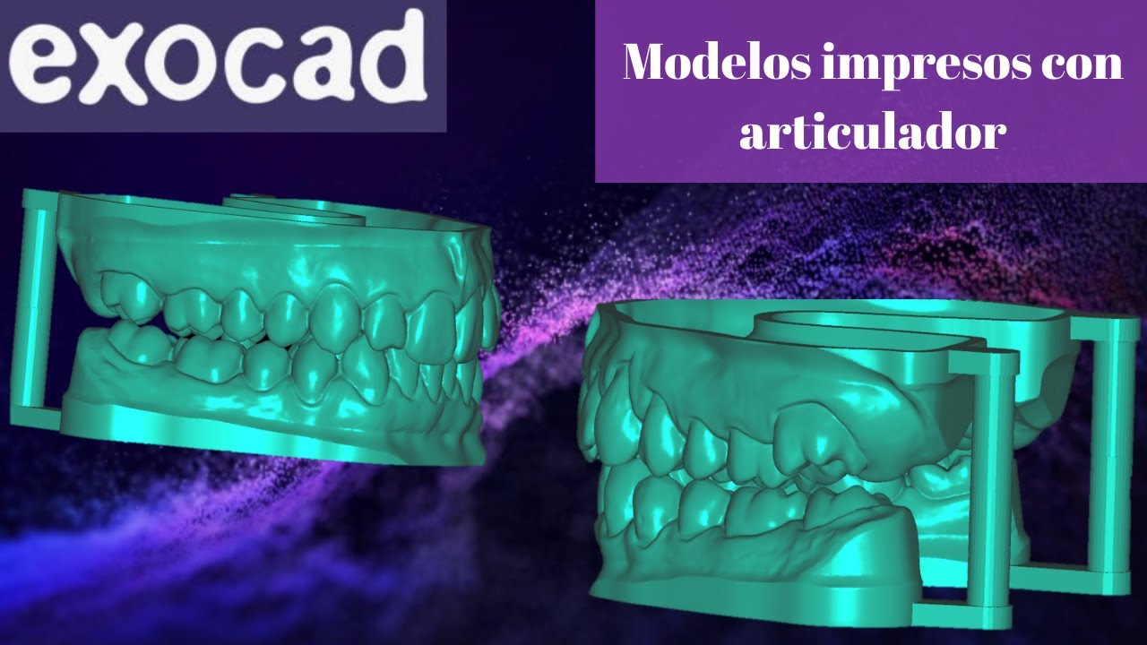 Modelos con articulador para imprimir 3D en exocad🚀🌀