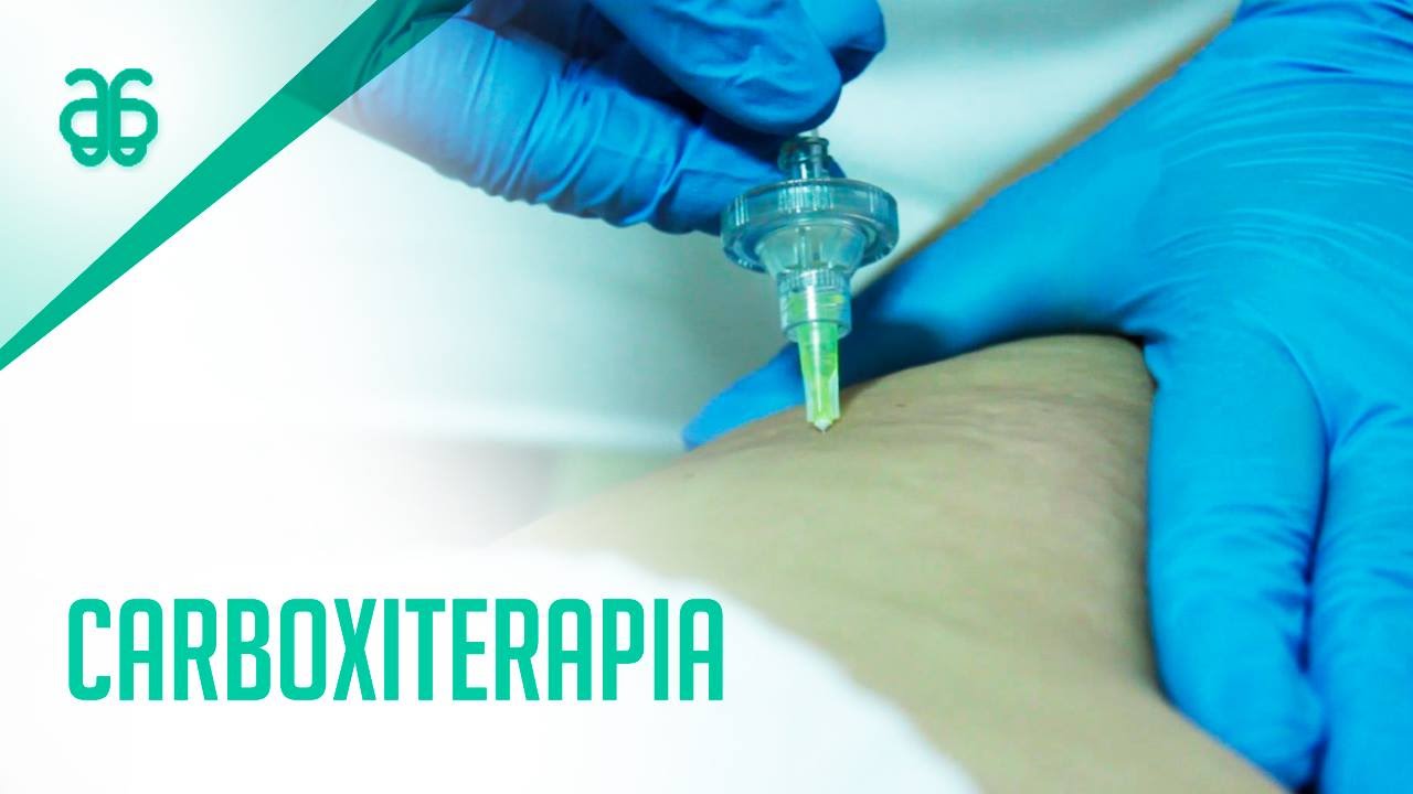 Carboxiterapia Facial e Corporal - YouTube