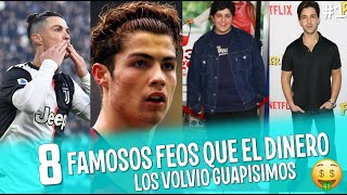8 Famosos Feos Que El Dinero Y Las Operaciones Los Volvió Guapísimos 2020 Tops Famosos