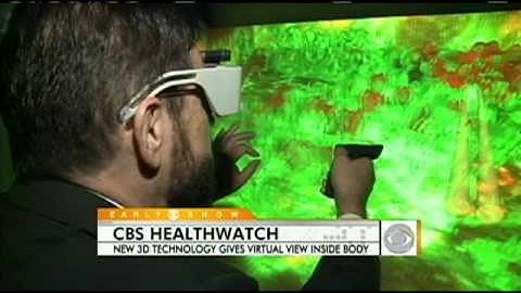 CAVE: A 3D Virtual View Inside the Body