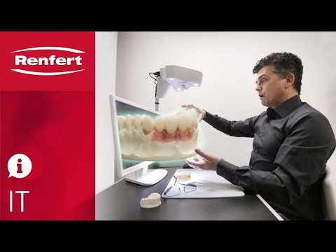 EASYview 3D Testimonial Giuseppe Doti