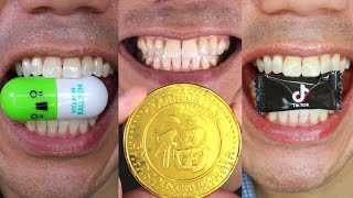 Doctor Tristan Peh's Ultimate Chewing ASMR – Click to Experience