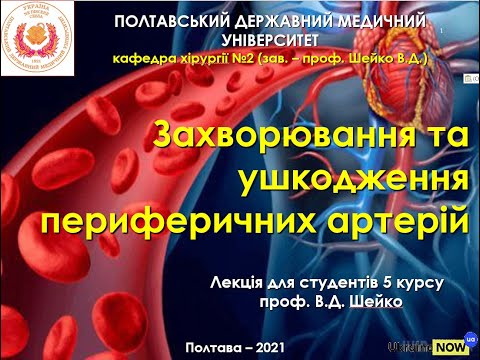 Лекция для студентов 5 курса мед.факультета. Заболевания периферических артерий. проф. В.Д.Шейко